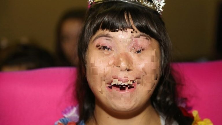 La ANSeS le quitó la pensión a una chica down de Arrecifes