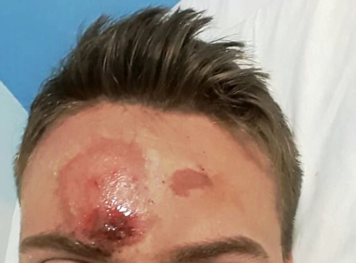 Atropellaron intencionalmente a su hermano y pide datos a través de las redes sociales