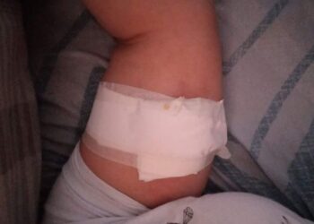 Gravísimo: en el Hospital de Arrecifes le inyectaron formol en lugar de anestesia