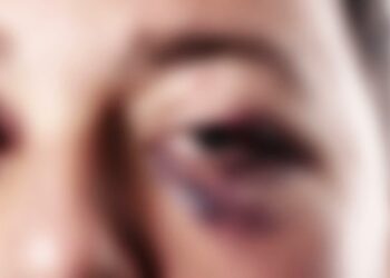 Otra denuncia por un hecho de violencia social