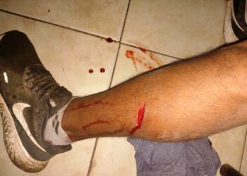 Trabajador municipal resultó herido por una botella