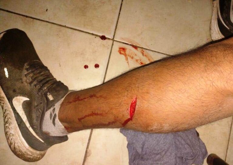 Trabajador municipal resultó herido por una botella