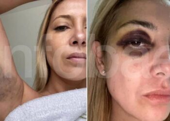 Se conocieron las primeras fotos de Fabiola Yañez golpeada