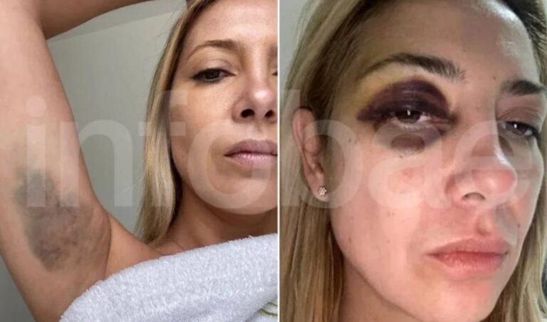 Se conocieron las primeras fotos de Fabiola Yañez golpeada