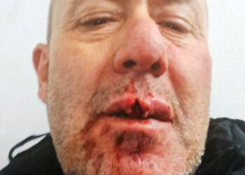 El árbitro Daniel Muñoz fue brutalmente agredido en Salto