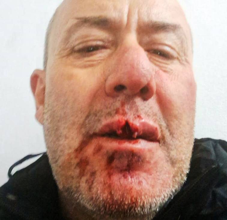 El árbitro Daniel Muñoz fue brutalmente agredido en Salto