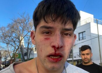 Atacaron al hijo de candidata a diputada en la visita de Milei a Junín