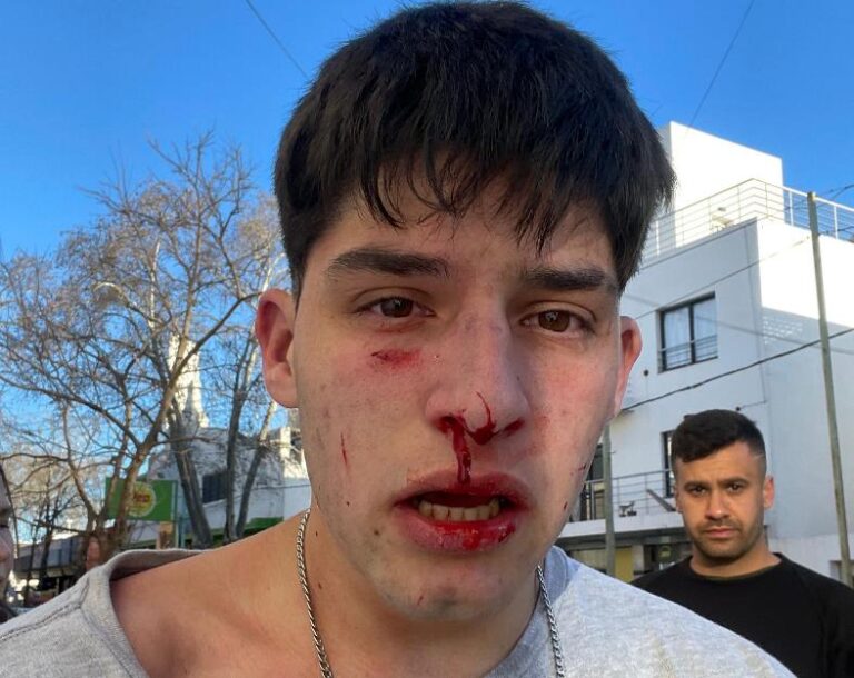 Atacaron al hijo de candidata a diputada en la visita de Milei a Junín