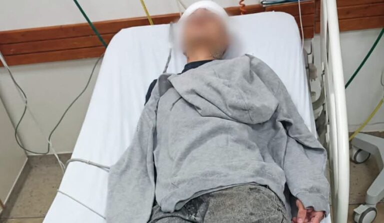Atacaron a botellazos a un menor para robarle la gorra en Guernica