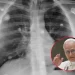 El Papa León XIV será operado: ¿puede venir a la Argentina?